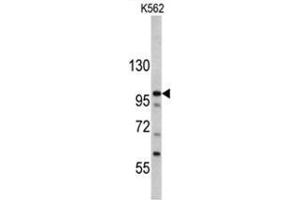 Western blot analysis of MTBP antibody (C-term) in K562 cell line lysates (35ug/lane).