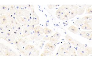Detection of GSTA4 in Human Cardiac Muscle Tissue using Polyclonal Antibody to Glutathione S Transferase A4 (GSTA4) (GSTA4 Antikörper  (AA 3-222))