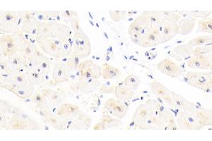 Detection of GSTA4 in Human Cardiac Muscle Tissue using Polyclonal Antibody to Glutathione S Transferase A4 (GSTA4) (GSTA4 Antikörper  (AA 3-222))