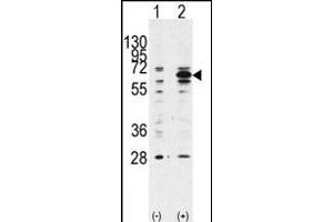 Western blot analysis of anti-hBECN1- Pab (ABIN388545 and ABIN2849691) in 293 cell line lysates transiently transfected with the BECN1 gene (2 μg/lane).