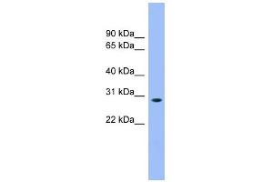 WB Suggested Anti-ENOPH1 Antibody Titration: 0. (MASA Antikörper  (N-Term))