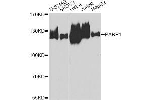 Western blot analysis of extracts of various cell lines, using PARP1 antibody. (PARP1 Antikörper)