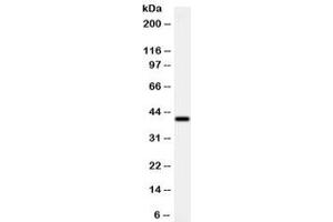 Western blot testing of human MCF7 cell lysate with ADK antibody at 0. (ADK Antikörper)