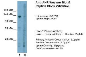 Host:  Rabbit  Target Name:  AHR  Sample Type:  HepG2  Lane A:  Primary Antibody  Lane B:  Primary Antibody + Blocking Peptide  Primary Antibody Concentration:  5. (Aryl Hydrocarbon Receptor Antikörper  (N-Term))