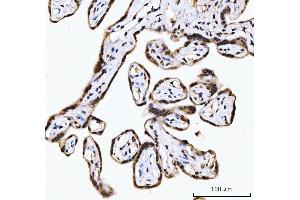 IHC analysis of RING2/RING1B/RNF2 using anti-RING2/RING1B/RNF2 antibody (ABIN7599286). (RNF2 Antikörper  (AA 1-336))