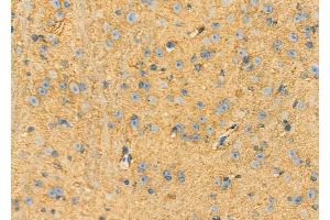 ABIN6262957 and ABIN6273262 at 1/100 staining Mouse brain tissue by IHC-P. (DHX58 Antikörper  (Internal Region))