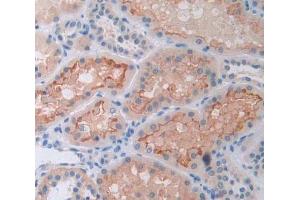 Used in DAB staining on fromalin fixed paraffin- embedded Kidney tissue (CD38 Antikörper  (AA 81-298))