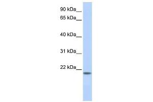 FLJ33706 antibody used at 5 ug/ml to detect target protein. (FLJ33706 (C-Term) Antikörper)