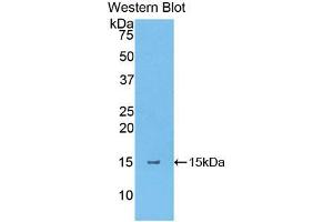 Western blot analysis of the recombinant protein. (Thymic Stromal Lymphopoietin Antikörper  (AA 75-196))
