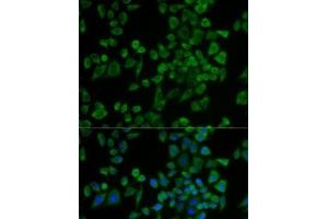 Immunofluorescence analysis of U2OS cells using P2RY2 Polyclonal Antibody (P2RY2 Antikörper)