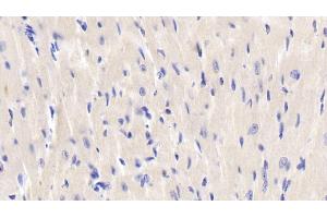 Detection of JNK1 in Mouse Cardiac Muscle Tissue using Polyclonal Antibody to c-Jun N-terminal Kinase 1 (JNK1) (C-Jun N-Terminal Kinases (AA 138-382) Antikörper)