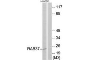 Western blot analysis of extracts from HuvEc cells, using RAB37 Antibody. (RAB37 Antikörper  (AA 170-219))