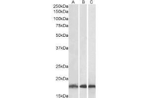 Western Blotting (WB) image for anti-Ubiquitin-Conjugating Enzyme E2L 3 (UBE2L3) antibody (ABIN5894613) (UBE2L3 Antikörper)