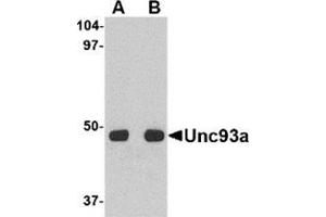 Western blot analysis of Unc93a in HeLa cell lysate with this product at (A) 0. (UNC93A Antikörper  (C-Term))