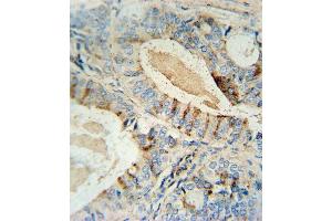 Immunohistochemistry (Paraffin-embedded Sections) (IHC (p)) image for anti-Glucosaminyl (N-Acetyl) Transferase 2, I-Branching Enzyme (I Blood Group) (GCNT2) (AA 364-391), (C-Term) antibody (ABIN654173)