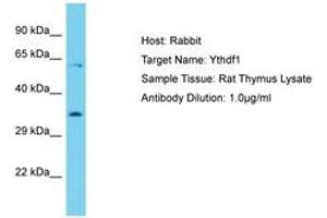 Image no. 1 for anti-YTH Domain Family, Member 1 (YTHDF1) (AA 127-176) antibody (ABIN6750377)