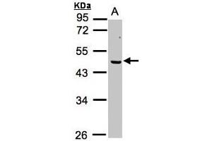 Image no. 1 for anti-Excision Repair Cross-Complementing Rodent Repair Deficiency, Complementation Group 8 (ERCC8) (AA 1-164) antibody (ABIN467383) (ERCC8 Antikörper  (AA 1-164))