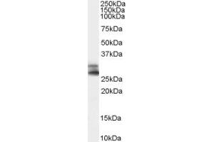 Western Blotting (WB) image for anti-ADP-Ribosylation-Like Factor 6 Interacting Protein 4 (ARL6IP4) (Middle Region) antibody (ABIN2790727) (ARL6IP4 Antikörper  (Middle Region))
