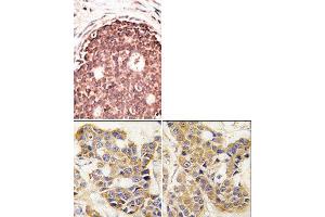 Image no. 2 for anti-Matrix Metallopeptidase 9 (Gelatinase B, 92kDa Gelatinase, 92kDa Type IV Collagenase) (MMP9) (C-Term) antibody (ABIN358703)