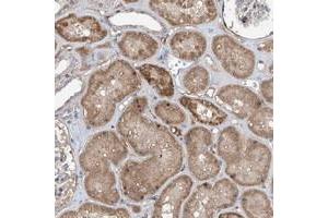 Immunohistochemical staining of human kidney with FAM135A polyclonal antibody  shows moderate cytoplasmic positivity in tubular cells. (FAM135A Antikörper)