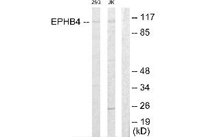 Western blot analysis of extracts from 293 cells and Jurkat cells, using EPHB4 antibody. (EPH Receptor B4 Antikörper  (Internal Region))
