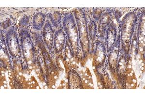 Immunohistochemistry (IHC) image for anti-Adhesion Regulating Molecule 1 (Adrm1) (AA 2-407) antibody (ABIN7443221)