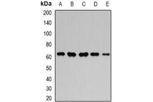 Western blot analysis of GPI expression in MCF7 (A), Hela (B), mouse kidney (C), mouse heart (D), rat brain (E) whole cell lysates.