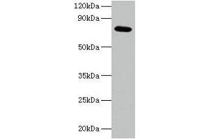 Western blot All lanes: ARPC3 antibody at 2 μg/mL + 293T whole cell lysate Secondary Goat polyclonal to rabbit IgG at 1/15000 dilution Predicted band size: 21 kDa Observed band size: 75 kDa (ARPC3 Antikörper  (AA 2-175))