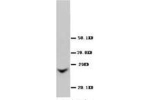 Western blot analysis of Rat liver sections using Connexin 26 antibody (GJB2 Antikörper  (Middle Region))