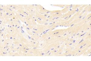 Detection of ERb in Mouse Cardiac Muscle Tissue using Polyclonal Antibody to Estrogen Receptor Beta (ERb) (ESR2 Antikörper  (AA 46-530))