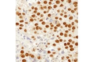 Immunohistochemistry (IHC) image for anti-Mismatch Repair Protein 2 (MSH2) (C-Term) antibody (ABIN7448673) (MSH2 Antikörper  (C-Term))