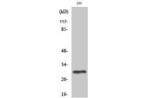 Western Blotting (WB) image for anti-Phosphatidylinositol Glycan Anchor Biosynthesis, Class X (PIGX) (C-Term) antibody (ABIN3186445) (PIGX Antikörper  (C-Term))