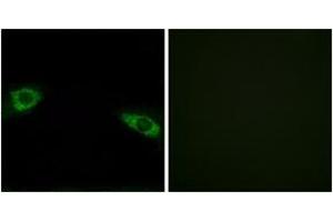 Immunofluorescence analysis of HuvEc cells, using RPS4Y1 Antibody.