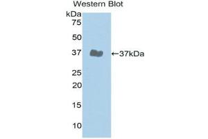 Western Blotting (WB) image for anti-Janus Kinase 2 (JAK2) (AA 508-800) antibody (ABIN3203633) (JAK2 Antikörper  (AA 508-800))