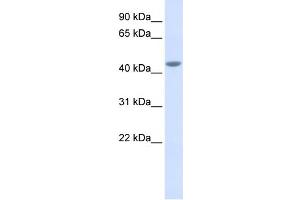 WB Suggested Anti-IL11RA Antibody Titration:  0. (IL11RA Antikörper  (Middle Region))