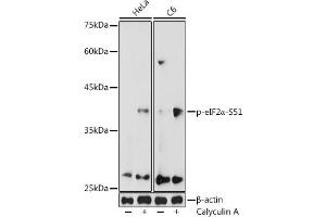 Western blot analysis of extracts of various cell lines, using Phospho-eIF2α-S51 antibody (ABIN3020189, ABIN3020190, ABIN3020191 and ABIN1681553) at 1:1000 dilution. (EIF2S1 Antikörper  (pSer51))