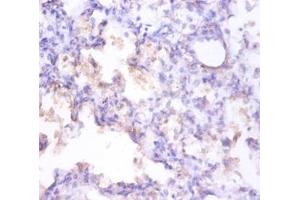 Immunohistochemistry of paraffin-embedded human prostate using CLU / Clusterin antibody at dilution of 1:100. (Clusterin Antikörper  (FITC))
