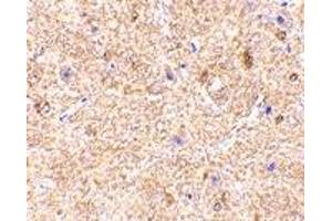Immunohistochemistry (IHC) image for anti-Mitochondrial Antiviral Signaling Protein (MAVS) (Middle Region) antibody (ABIN1031160) (MAVS Antikörper  (Middle Region))