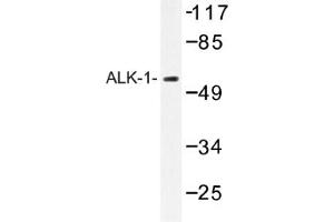 Image no. 1 for anti-Activin A Receptor Type II-Like 1 (ACVRL1) antibody (ABIN317607) (ACVRL1 Antikörper)