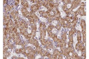 ABIN6277347 at 1/100 staining human liver tissue sections by IHC-P. (CPT2 Antikörper  (Internal Region))
