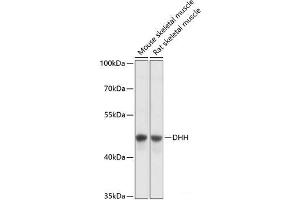 Western blot analysis of extracts of various cell lines using DHH Polyclonal Antibody at dilution of 1:3000. (desert Hedgehog Antikörper)