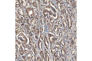 IHC analysis of SCO1 using anti-SCO1 antibody (ABIN7600609). (SCO1 Antikörper  (AA 21-301))