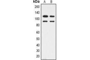 Western blot analysis of CDK11B expression in HepG2 (A), Hela (B) whole cell lysates. (CDK11 Antikörper  (N-Term))