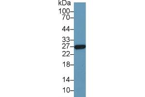 Detection of GSTa5 in Human Liver lysate using Polyclonal Antibody to Glutathione S Transferase Alpha 5 (GSTa5)