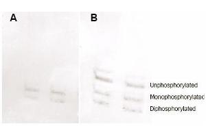 Immunoblotting. (MYL12A Antikörper  (pSer19, pSer20))