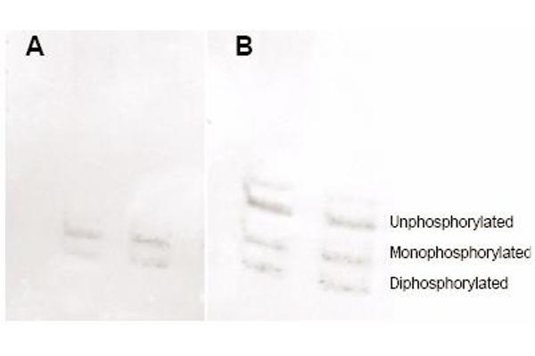 MYL12A Antikörper  (pSer19, pSer20)