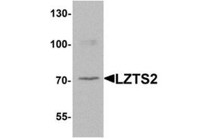 Western blot analysis of LZTS2 in human kidney tissue lysate with LZTS2 Antibody  at 1 μg/ml. (LZTS2 Antikörper  (N-Term))