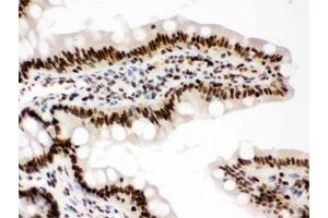 IHC testing of FFPE rat intestine with RBBP4 antibody. (RBBP4 / RbAp48 / NURF55 Antikörper)