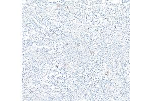 Immunohistochemistry (IHC) image for anti-Killer Cell Lectin-Like Receptor Subfamily C, Member 1 (KLRC1) (AA 1-50) antibody (ABIN7795693)