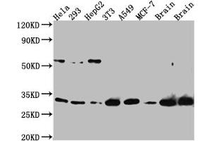 Western Blot Positive WB detected in: Hela whole cell lysate, 293 whole cell lysate, HepG2 whole cell lysate, NIH/3T3 whole cell lysate, A549 whole cell lysate, MCF-7 whole cell lysate, Mouse Brain whole cell lysate, Rat Brain whole cell lysate All lanes: PGAM1 Antibody at 1:1000 Secondary Goat polyclonal to rabbit IgG at 1/50000 dilution Predicted band size: 28 kDa Observed band size: 29 kDa (Rekombinanter PGAM1 Antikörper)